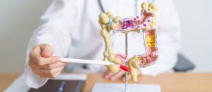 doenças inflamatórias intestinais