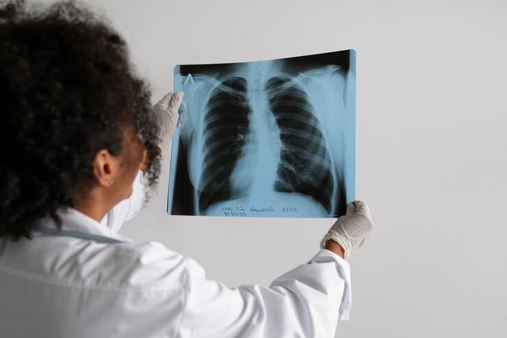 Médica analisando uma radiografia de tórax, representando a avaliação de um paciente com DPOC.