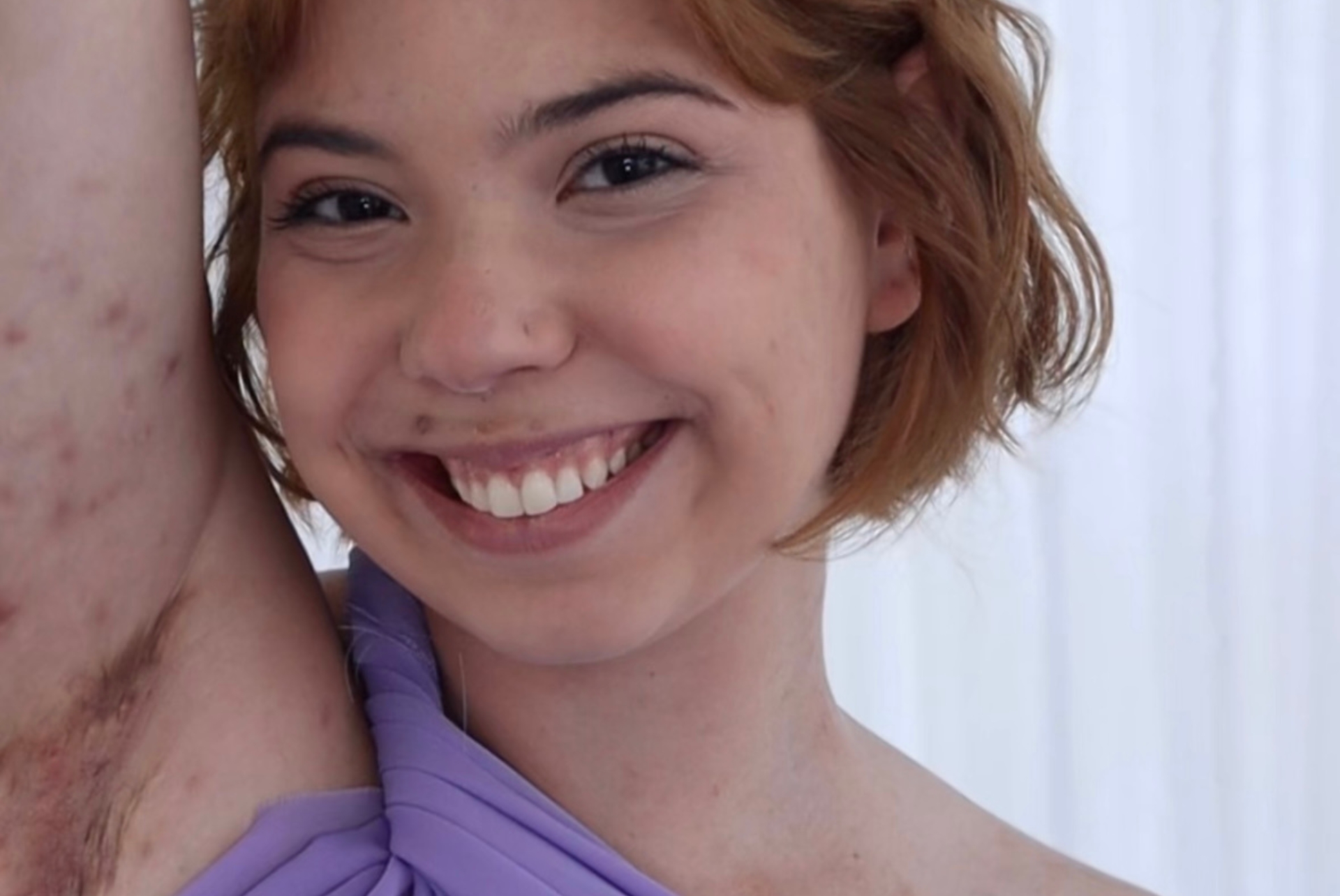 Rayssa Machado, paciente com lúpus, compartilhando sua jornada de diagnóstico e acolhimento